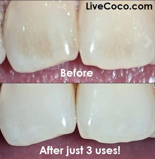 Teeth Cleaning Powder (Vitamins & Aloe Vera Infused)